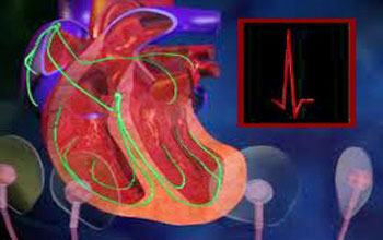 Myocardial perfusion imaging by Thallium - 201. 