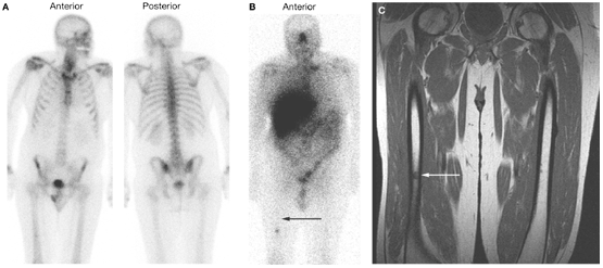  View of bone scans